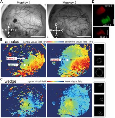 Axonal Projections From the Middle Temporal Area in the Common Marmoset